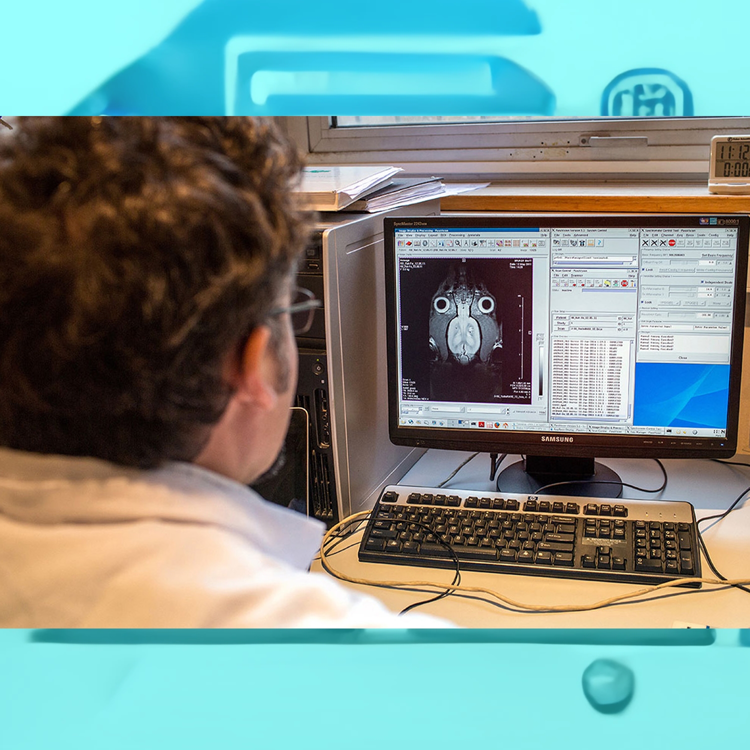 ¿Un asesino nace o se hace? Claves neurocientíficas para entender la conducta homicida